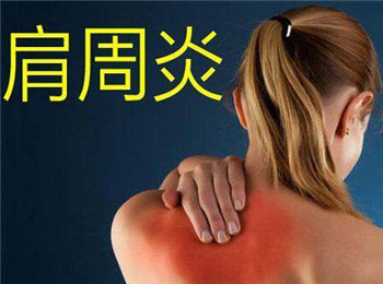 肩周炎的形成和哪些因素有关